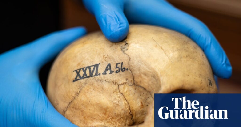 Edinburgh University’s ‘skull room’ highlights its complicated history with racist science | University of Edinburgh