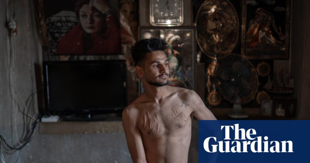 A man from Shiraz bares his scars: Shayan Sajadian’s best photograph | Photography