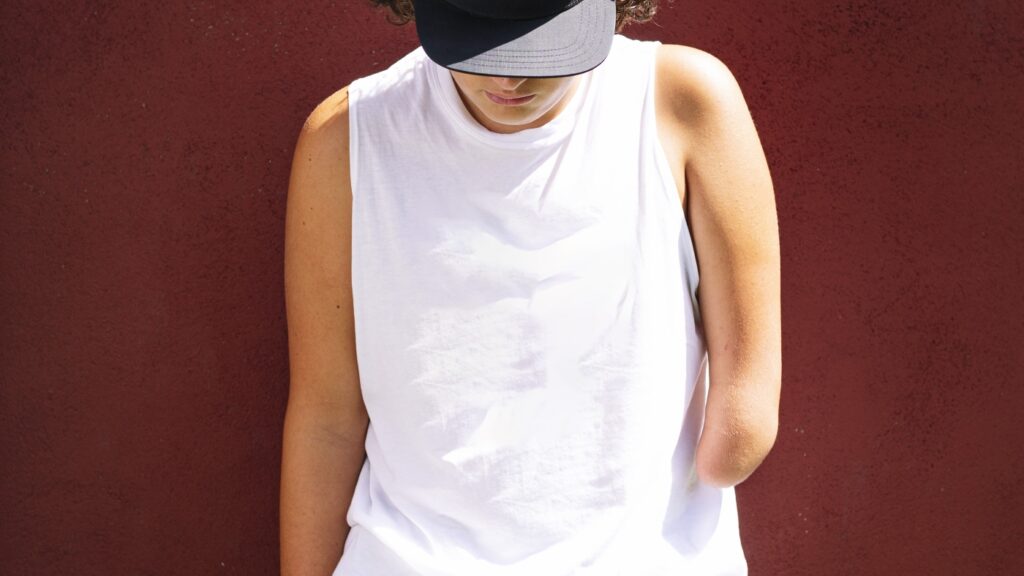 After an amputation, the brain remembers the body's lost limb : Shots