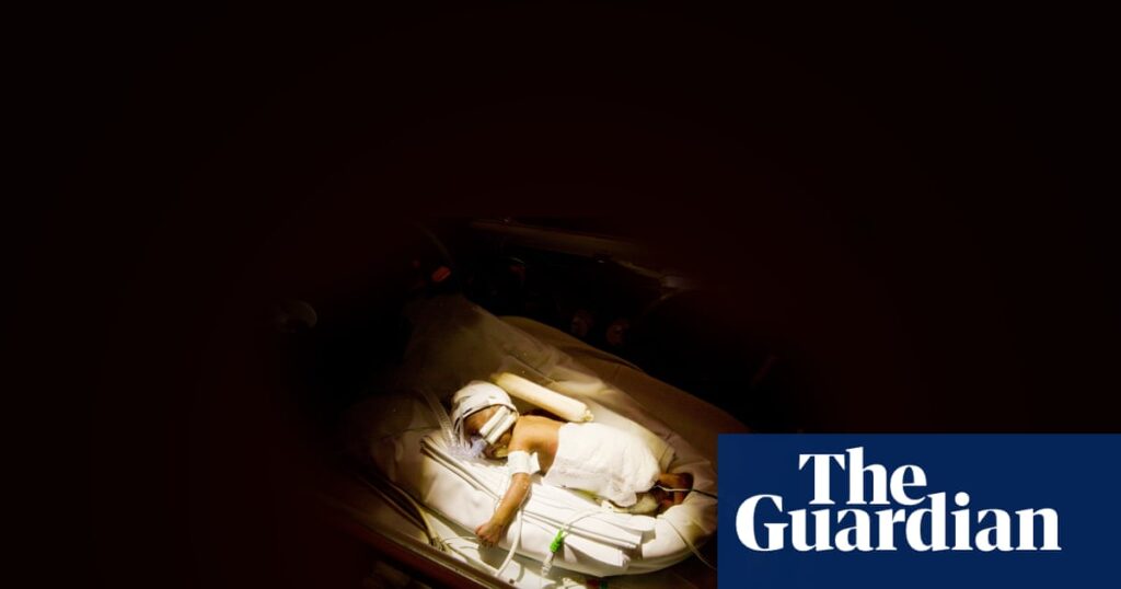 Best of 2025 … so far: ‘Look, they’re getting skin!’: are we right to strive to save the world’s tiniest babies? – podcast | Premature birth