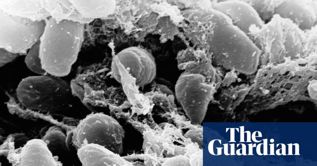 California resident tests positive for the plague after camping, officials say | California California resident tests positive for the plague after camping, officials say | California