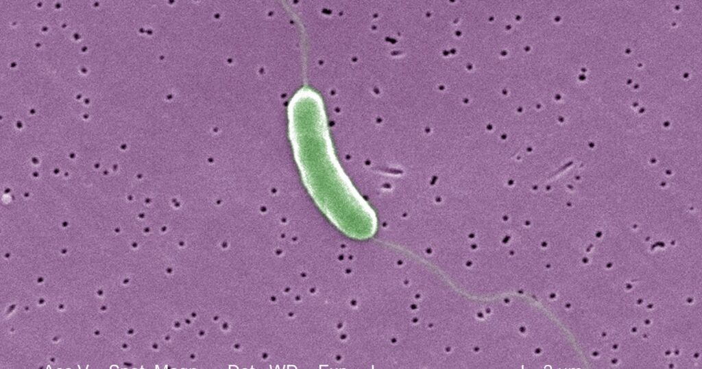 Flesh-eating bacteria kills 5th person this year in Louisiana