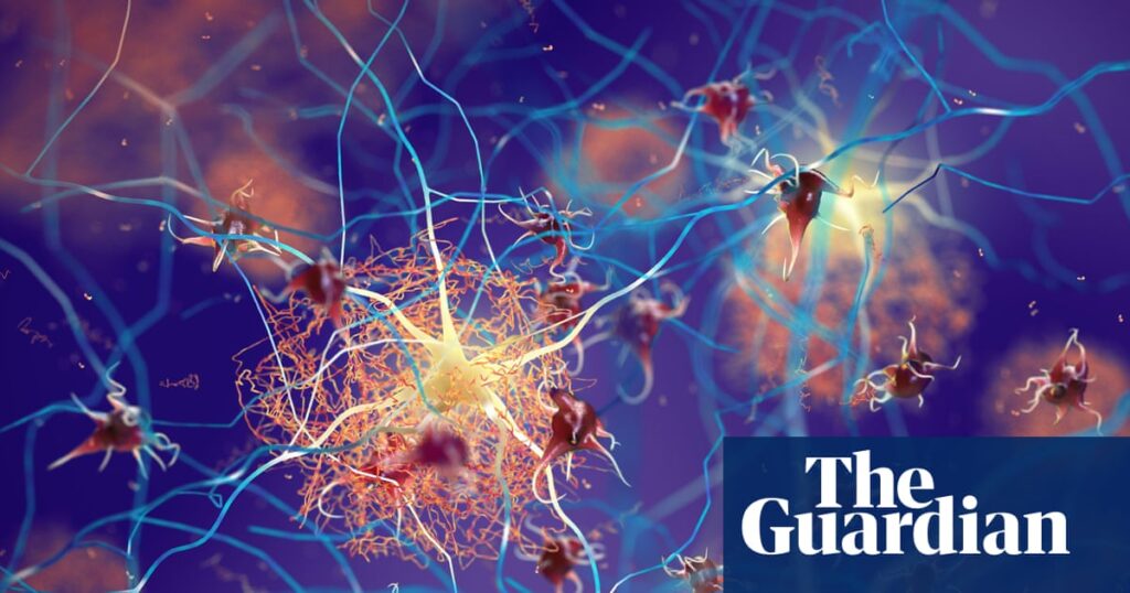 Is there hope on the horizon for patients with Alzheimer’s? – podcast | Science