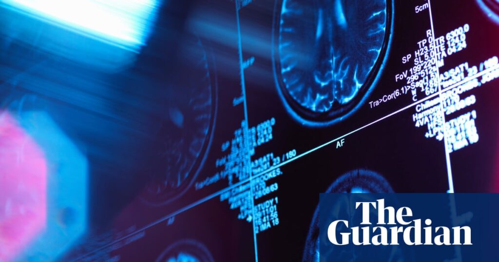 Study links greater inequality to structural changes in children’s brains | Medical research