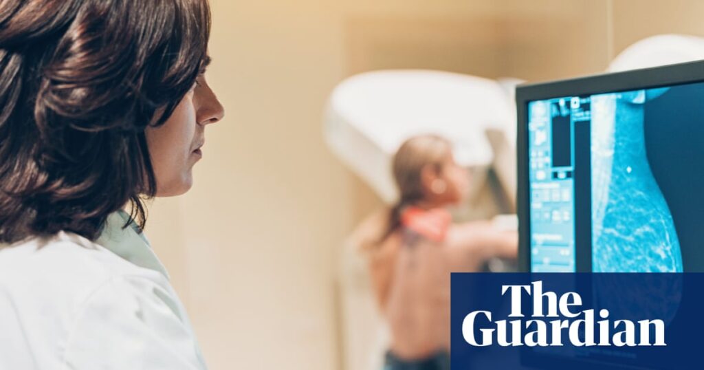 Women who miss first breast cancer screening at ‘40% higher risk’ of dying from the disease | Breast cancer
